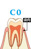 C0