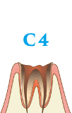 C4